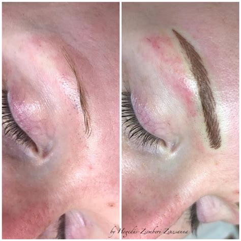 Denza lézeres szemöldök dúsítás eredménye