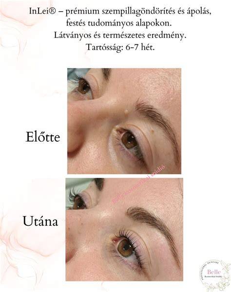 szempilla elott utana infografika