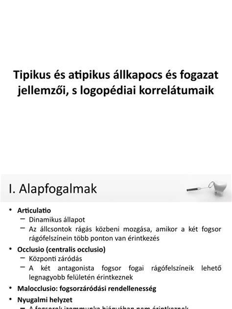 Táblázat: tipikus hajgöndörítők jellemzői