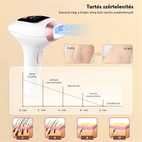 IPL technológia szőrtelenítés