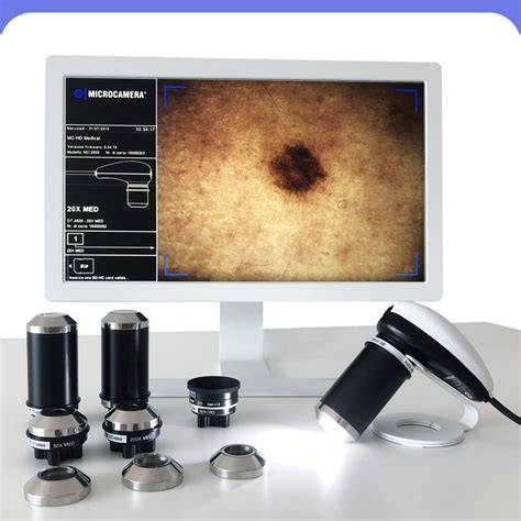 O’Rising mikrokamera a fejbőr diagnosztikához